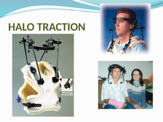 HALO TRACTION
 