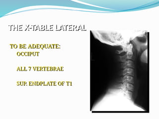 THE X-TABLE LATERAL
TO BE ADEQUATE:
OCCIPUT
ALL 7 VERTEBRAE
SUP. ENDPLATE OF T1
 