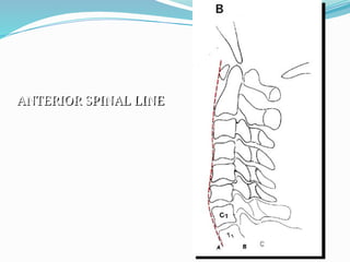 ANTERIOR SPINAL LINE
 