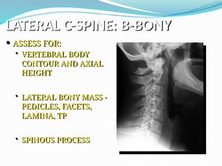 LATERAL C-SPINE: B-BONY
 ASSESS FOR:
• VERTEBRAL BODY
CONTOUR AND AXIAL
HEIGHT
• LATERAL BONY MASS -
PEDICLES, FACETS,
LAMINA, TP
• SPINOUS PROCESS
 