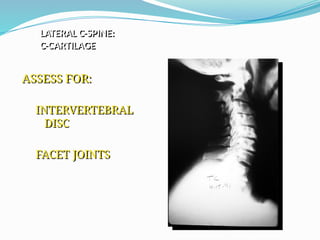 ASSESS FOR:
INTERVERTEBRAL
DISC
FACET JOINTS
LATERAL C-SPINE:
C-CARTILAGE
 