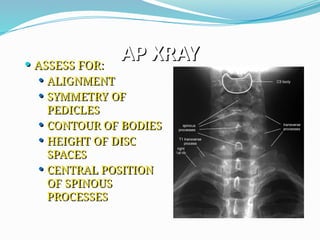 AP XRAY
 ASSESS FOR:
 ALIGNMENT
 SYMMETRY OF
PEDICLES
 CONTOUR OF BODIES
 HEIGHT OF DISC
SPACES
 CENTRAL POSITION
OF SPINOUS
PROCESSES
 