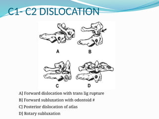 C1- C2 DISLOCATION
A] Forward dislocation with trans lig rupture
B] Forward subluxation with odontoid #
C] Posterior dislocation of atlas
D] Rotary subluxation
 