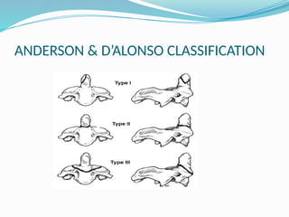 ANDERSON & D’ALONSO CLASSIFICATION
 