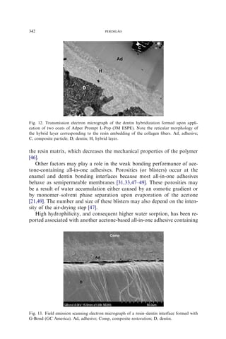 the resin matrix, which decreases the mechanical properties of the polymer
[46].
Other factors may play a role in the weak bonding performance of ace-
tone-containing all-in-one adhesives. Porosities (or blisters) occur at the
enamel and dentin bonding interfaces because most all-in-one adhesives
behave as semipermeable membranes [31,33,47–49]. These porosities may
be a result of water accumulation either caused by an osmotic gradient or
by monomer–solvent phase separation upon evaporation of the acetone
[21,49]. The number and size of these blisters may also depend on the inten-
sity of the air-drying step [47].
High hydrophilicity, and consequent higher water sorption, has been re-
ported associated with another acetone-based all-in-one adhesive containing
Fig. 12. Transmission electron micrograph of the dentin hybridization formed upon appli-
cation of two coats of Adper Prompt L-Pop (3M ESPE). Note the reticular morphology of
the hybrid layer corresponding to the resin embedding of the collagen ﬁbers. Ad, adhesive;
C, composite particle; D, dentin; H, hybrid layer.
Fig. 13. Field emission scanning electron micrograph of a resin–dentin interface formed with
G-Bond (GC America). Ad, adhesive; Comp, composite restoration; D, dentin.
342 PERDIGA˜ O
 