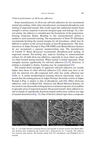 Clinical performance of all-in-one adhesives
Some manufacturers of all-in-one self-etch adhesives do not recommend
enamel pre-etching, while other manufacturers recommend phosphoric-acid
etching of unground enamel. One would argue that additional enamel bond
strength is always required to prevent marginal gaps and leakage. In a clin-
ical setting, the adhesive is extended past the boundaries of the preparation,
forming composite ﬂashes. Bonding to this uninstrumented surface is
needed to resist potential staining. The manufacturer of Xeno IV (Dentsply)
recommends beveling the enamel margins for all procedures, which may be
diﬃcult to achieve in the cervical margin of class-II preparations. The man-
ufacturers of Adper Prompt L-Pop (3M ESPE) and iBond (Heraeus Kulzer)
do not recommend a separate enamel-etching step. The manufacturer
of Clearﬁl S3
Bond (Kuraray) recommends phosphoric-acid etching of
unground enamel. Pre-etching may improve bonding to uninstrumented
surfaces for all mild all-in-one adhesives, especially in areas where an adhe-
sive ﬂash formed during insertion. When enamel is etched separately, bond
strengths increase signiﬁcantly for self-etch adhesives [52,55]. However, if
etching is extended to dentin, bonding may be compromised [52].
The enamel bond strengths of aggressive self-etch adhesives are usually
higher than those of other self-etch adhesives [55], which may have to do
with the relatively low pH compared with other less acidic adhesives (see
Table 1). A recent morphological scanning electron microscopy study re-
ported that the etching pattern on Adper Prompt, the bottle version of Adper
Prompt L-Pop, is similar to that of phosphoric acid [56]. Other all-in-one
adhesives, such as G-Bond (GC America) and iBond (Heraeus Kulzer), do
not result in any discernible etching pattern or minimal exposure of crystallites
in sporadic areas of unground enamel. On ground enamel, these adhesives re-
sult in islands of superﬁcially dissolved enamel within areas without any sign
of enamel dissolution (Fig. 15). One of the ﬁrst clinical signs that a composite
Fig. 15. (A) Field emission scanning electron micrograph of enamel treated with iBond (Her-
aeus Kulzer) after roughening the enamel with a diamond bur for 5 seconds. The adhesive
was removed with acetone. (B) Enamel etched with 38% phosphoric acid (Pulpdent) for 15
seconds.
349DENTAL ADHESION
 