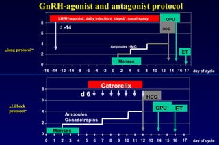 8 
6 
4 
2 
0 
8 
6 
4 
2 
0 
LHRH-agonist: daily injection/ depot/ nasal spray 
d 6 
d -14 
Ampoules 
Gonadotropins 
Menses 
Ampoules HMG 
Menses 
Cetrorelix 
HCG 
OPU 
HCG 
OPU 
ET 
ET 
0 1 2 3 4 5 6 7 8 9 10 11 12 13 14 15 16 17 
day of cycle 
-16 -14 -12 -10 -8 -6 -4 -2 0 2 4 6 8 10 12 14 16 
17 day of cycle 
„long protocol“ 
„Lübeck 
protocol“ 
GnRH-agonist and antagonist protocol 
 
