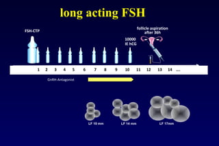 long acting FSH 
FSH-CTP 
10000 
IE hCG 
follicle aspiration 
after 36h 
1 2 3 4 5 6 7 8 9 10 11 12 13 14 …. 
GnRH-Antagonist 
LF 10 mm LF 14 mm LF 17mm 
 