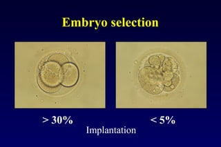 Embryo selection 
> 30% < 5% 
Implantation 
 