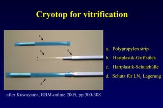 Cryotop for vitrification 
after Kuwayama, RBM-online 2005, pp.300-308 
a. Polypropylen strip 
b. Hartplastik-Griffstück 
c. Hartplastik-Schutzhülle 
d. Schutz für LN2 Lagerung 
 