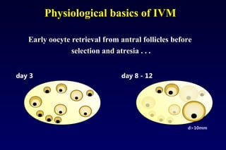 Physiological basics of IVM 
Early oocyte retrieval from antral follicles before 
selection and atresia . . . 
day 3 day 8 - 12 
d>10mm 
 