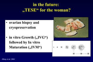 in the future: 
„TESE“ for the woman? 
• ovarian biopsy and 
cryopreservation 
• in vitro Growth („IVG“) 
followed by In vitro 
Maturation („IVM“) 
Oktay et al. 2004 
 