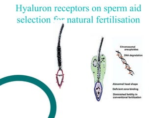Hyaluron receptors on sperm aid
selection for natural fertilisation
 