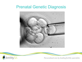 Prenatal Genetic Diagnosis
 