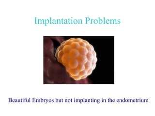Implantation Problems




Beautiful Embryos but not implanting in the endometrium
 