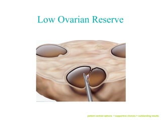 Low Ovarian Reserve




           patient centred options + supportive choices + outstanding results
 
