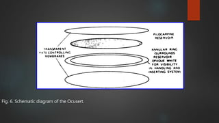 Ocuset Formulation New drug delivery system | PPTX