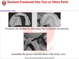 RELINING REBASING AND REPAIR OF COMPLETE DENTURE.ppt