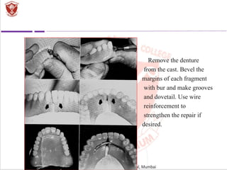 RELINING REBASING AND REPAIR OF COMPLETE DENTURE.ppt