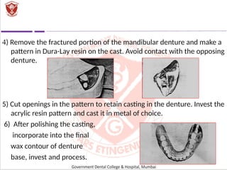 RELINING REBASING AND REPAIR OF COMPLETE DENTURE.ppt