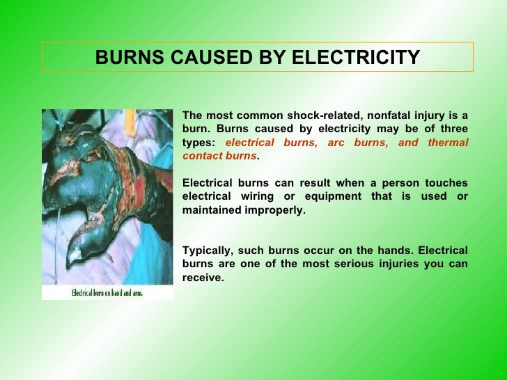 What Are The 4 Main Types Of Electrical Injury Pat La vrogue.co