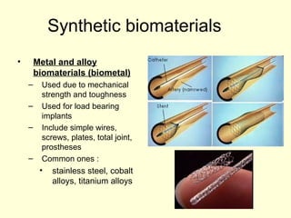 Synthetic biomaterials 
• Metal and alloy 
biomaterials (biometal) 
– Used due to mechanical 
strength and toughness 
– Used for load bearing 
implants 
– Include simple wires, 
screws, plates, total joint, 
prostheses 
– Common ones : 
• stainless steel, cobalt 
alloys, titanium alloys 
 