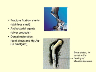 Bone plates, to 
assist in the 
healing of 
skeletal fractures, 
• Fracture fixation, stents 
(stainless steel) 
• Antibacterial agents 
(silver products) 
• Dental restoration 
(gold alloys and Hg-Ag- 
Sn amalgam) 
 