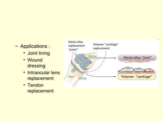 – Applications : 
• Joint lining 
• Wound 
dressing 
• Intraocular lens 
replacement 
• Tendon 
replacement 
 