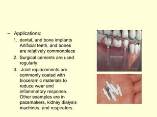 – Applications: 
1. dental, and bone implants 
Artificial teeth, and bones 
are relatively commonplace 
2. Surgical cements are used 
regularly 
3. Joint replacements are 
commonly coated with 
bioceramic materials to 
reduce wear and 
inflammatory response. 
Other examples are in 
pacemakers, kidney dialysis 
machines, and respirators. 
 