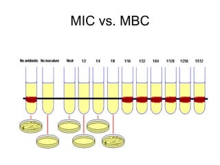 MIC vs. MBC
 