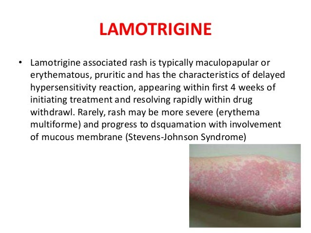 Newer antiepileptic drugs