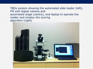TBDx system showing the automated slide loader (left),
FM with digital camera and
automated stage (centre), and laptop to operate the
reader and employ the scoring
algorithm (right)
 