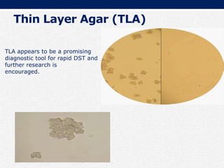 Thin Layer Agar (TLA)
TLA appears to be a promising
diagnostic tool for rapid DST and
further research is
encouraged.
 