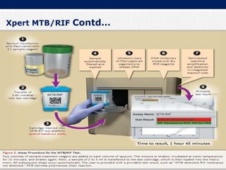 Xpert MTB/RIF Contd…
 