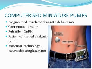 Computer Control Pulsatile Pump Newer drug delivery methods | PPTX