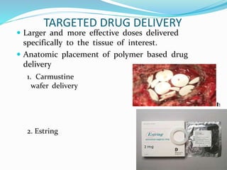 What Is Estring Delivery System? – PBFBDP