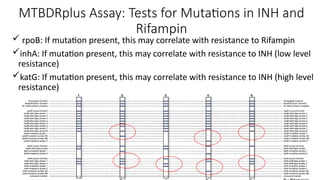 MTBDRplus Assay: Tests for Mutations in INH and
Rifampin
 rpoB: If mutation present, this may correlate with resistance to Rifampin
inhA: If mutation present, this may correlate with resistance to INH (low level
resistance)
katG: If mutation present, this may correlate with resistance to INH (high level
resistance)
 