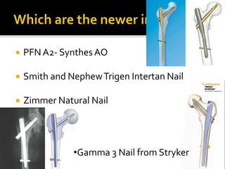  PFN A2- Synthes AO
 Smith and NephewTrigen Intertan Nail
 Zimmer Natural Nail
•Gamma 3 Nail from Stryker
 