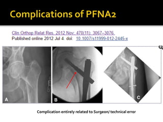 Complication entirely related to Surgeon/ technical error
 