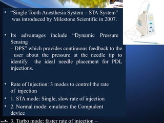 Sta Injection Newer LA Technique recent advancements in local anesthesia.pptx