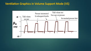 Volume Support Mode Advanced Mechanical Ventilation Modes: Principles and Clinical ...
