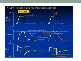 Newer modes of ventilation