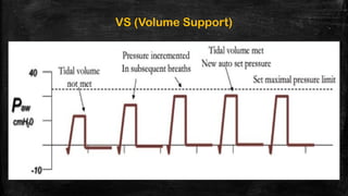 Volume Support Mode NEWER MODES OF VENTILATION 3. pptx | PPTX