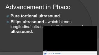 Advancement in Phaco
 Pure tortional ultrasound
 Ellips ultrasound - which blends
longitudinal ultrasound with transversal
ultrasound.
 