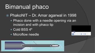 Bimanual phaco
 PhakoNIT – Dr. Amar agarwal in 1998
 Phaco done with a needle opening via an
incision and with phaco tip
 Cold BSS 4º
 Microflow needle
 