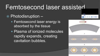 Femtosecond laser assisted
 Photodisruption –
 Femtosecond laser energy is
absorbed by the tissue
 Plasma of ionized molecules
rapidly expands, creating
cavitation bubbles.
 