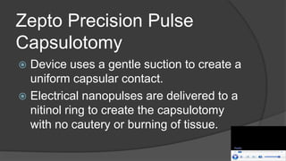 Zepto Precision Pulse
Capsulotomy
 Device uses a gentle suction to create a
uniform capsular contact.
 Electrical nanopulses are delivered to a
nitinol ring to create the capsulotomy
with no cautery or burning of tissue.
 