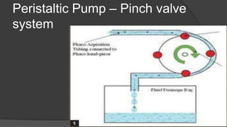 Peristaltic Pump – Pinch valve
system
 