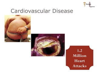 Cardiovascular Disease  1.2 Million Heart Attacks 