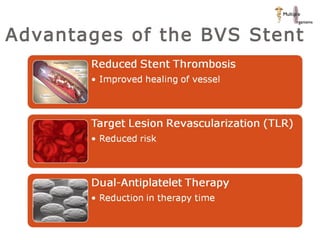 Advantages of the BVS Stent 